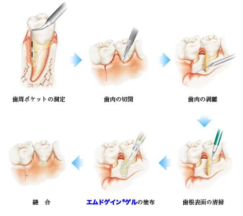 エムドゲインRゲル