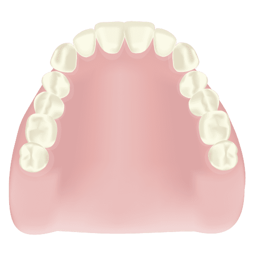 レジン入れ歯（保険対象の入れ歯）